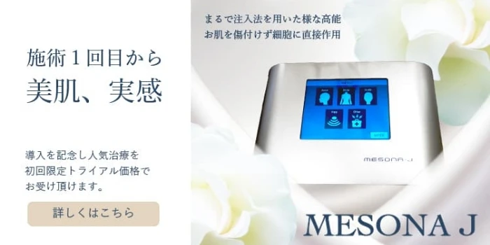 MESONA Jの画像