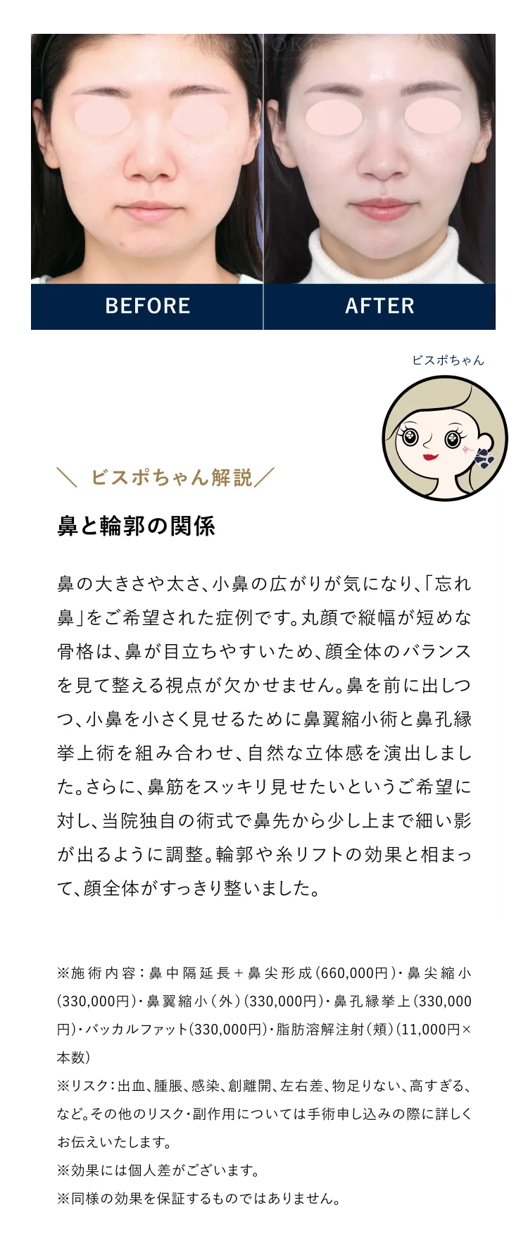 鼻と輪郭の関係