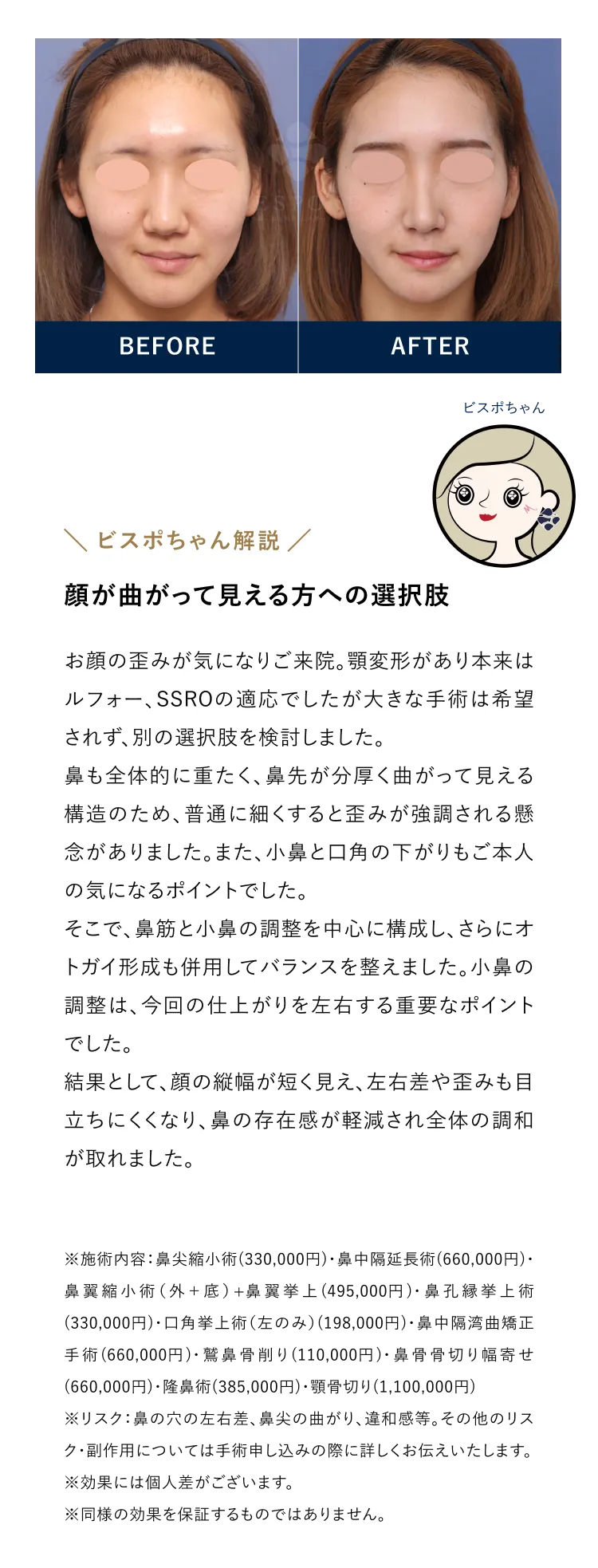 顔が曲がって見える方への選択肢