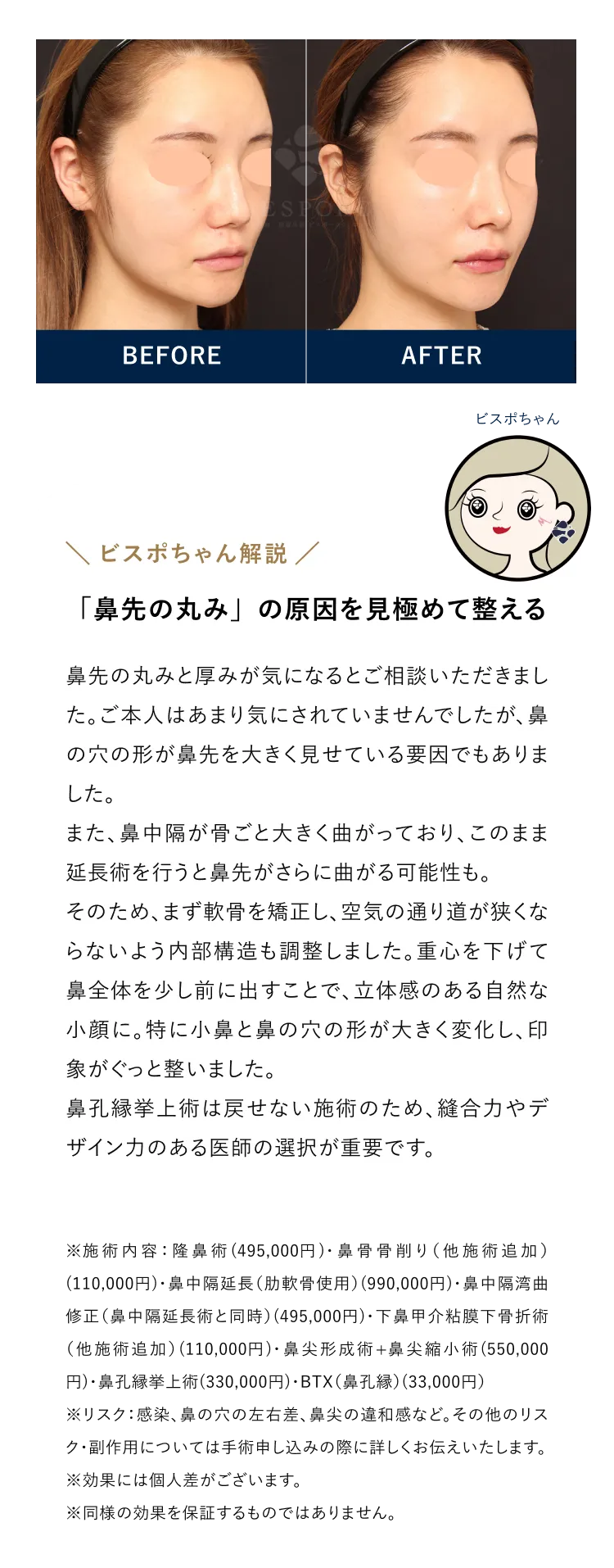 「鼻先の丸み」の原因を見極めて整える