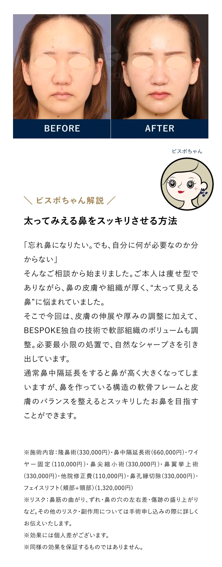 太ってみえる鼻をスッキリさせる方法
