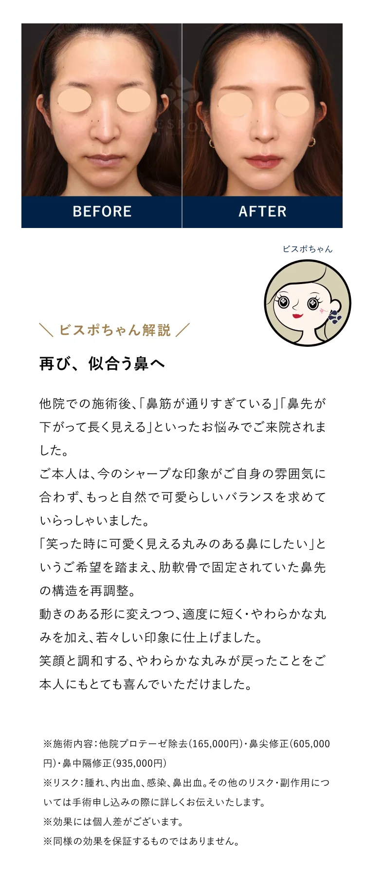 再び、似合う鼻へ
