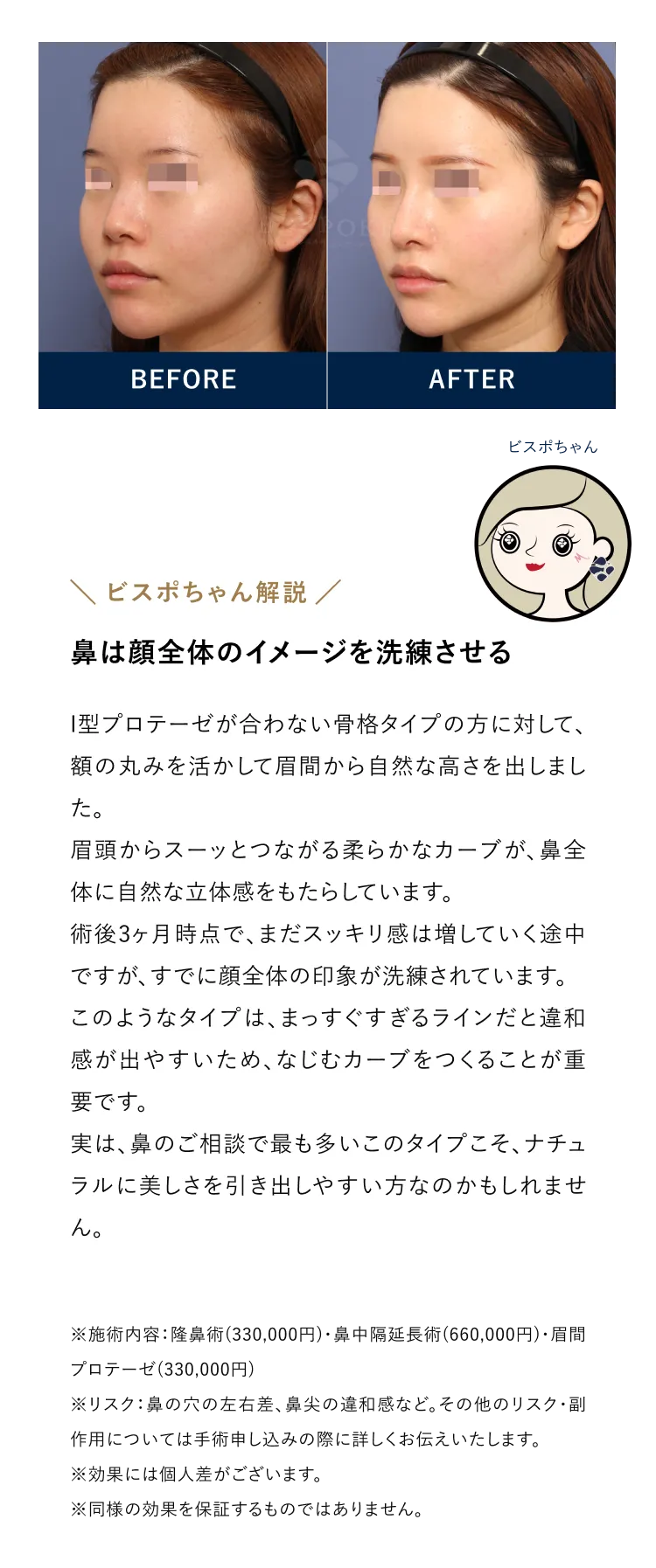 鼻は顔全体のイメージを洗練させる