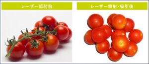 脂肪注入＿ダイオードレーザー