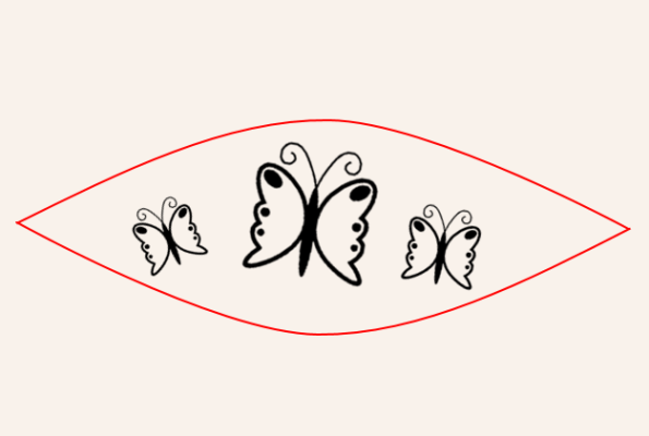 タトゥー（刺青）皮膚切除