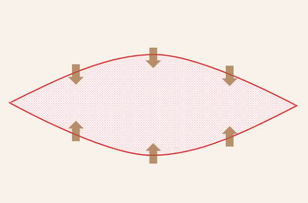 タトゥー（刺青）皮膚切除