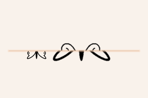 タトゥー（刺青）皮膚切除