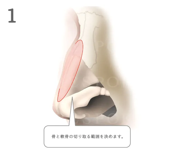 鷲鼻_図解