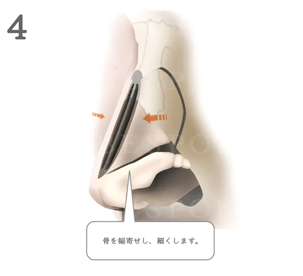 鷲鼻_図解