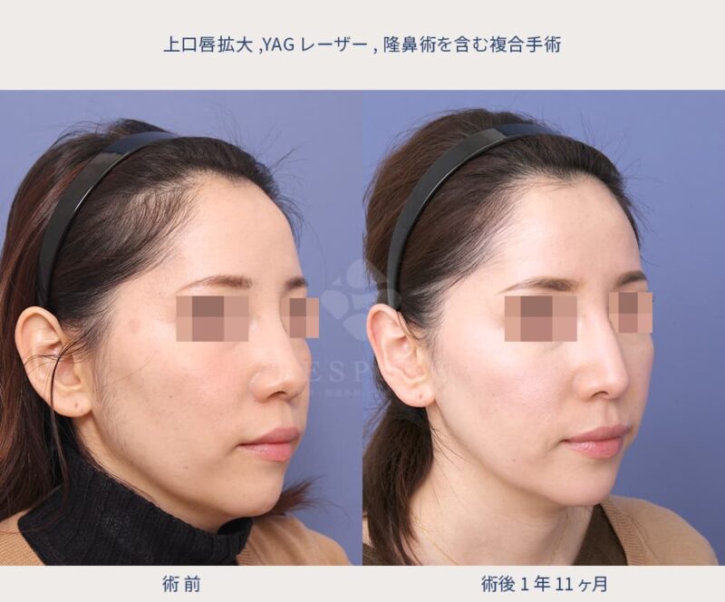 室医師による複合的な美容手術の症例写真