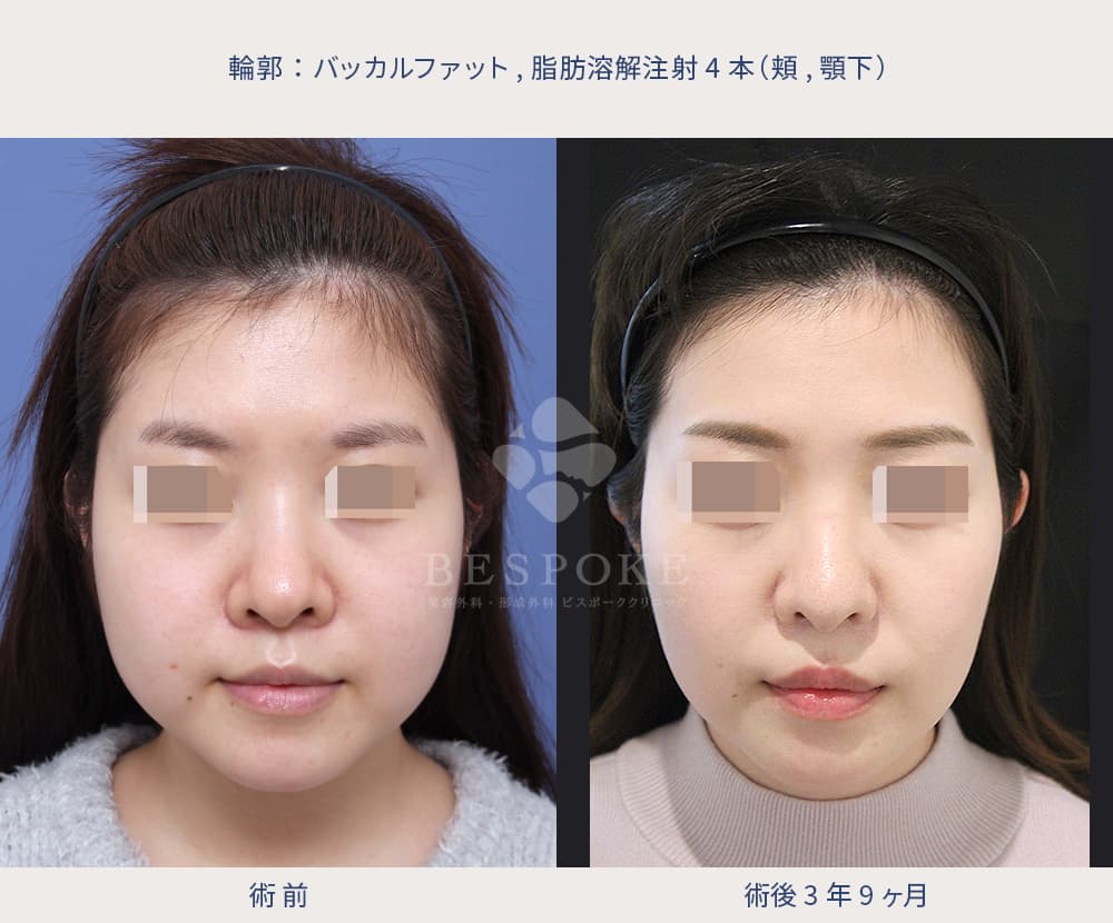 室医師による鼻と輪郭の美容手術の症例写真