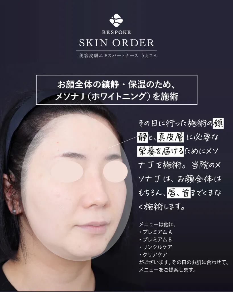 カスタマイズ肌治療（ビスポークオーダー）の症例