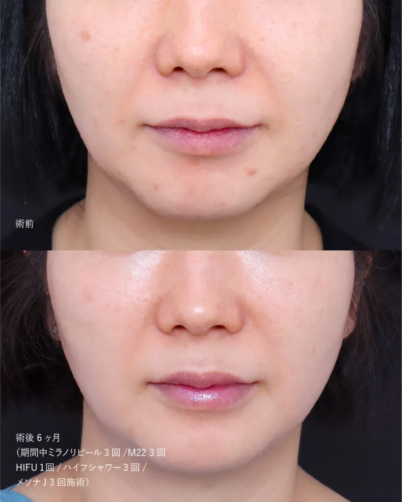 カスタマイズ肌治療の症例