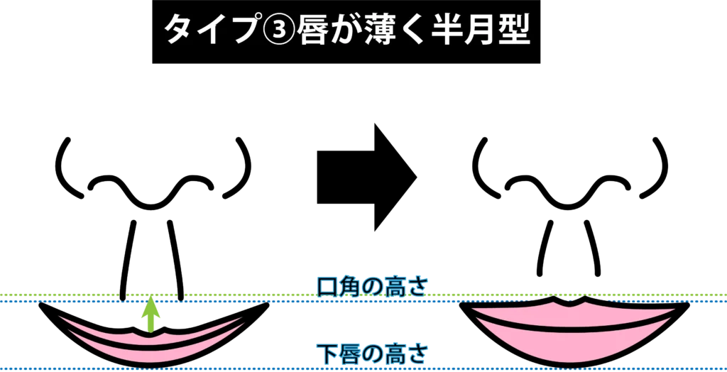 人中短縮術のポイント
