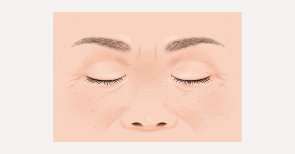 老化した人の鼻の画像