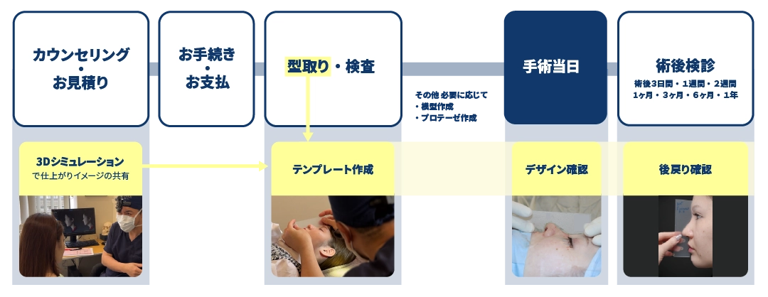 テンプレートサージャリーの流れ