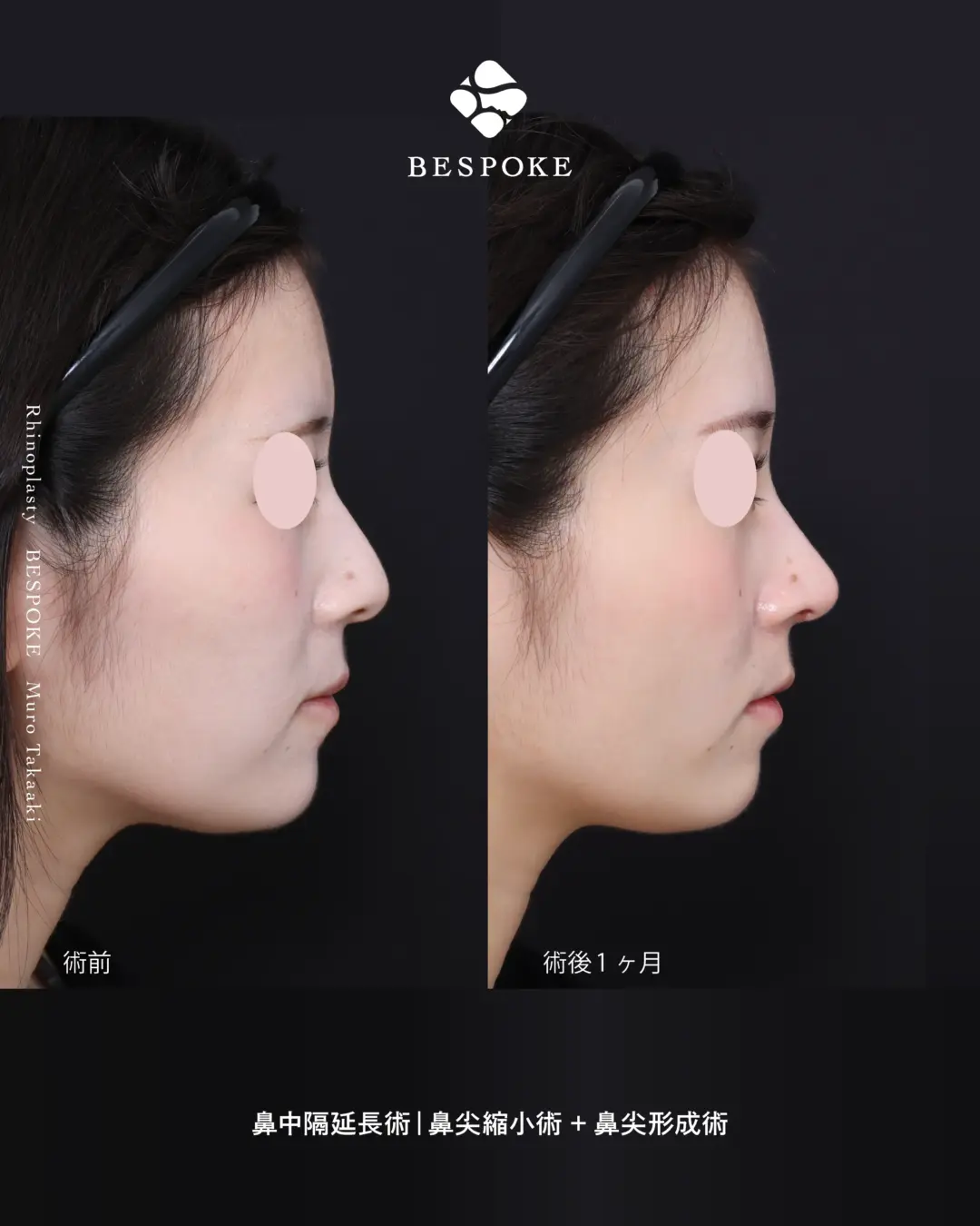 【鼻】"ベストバランス"を、極める