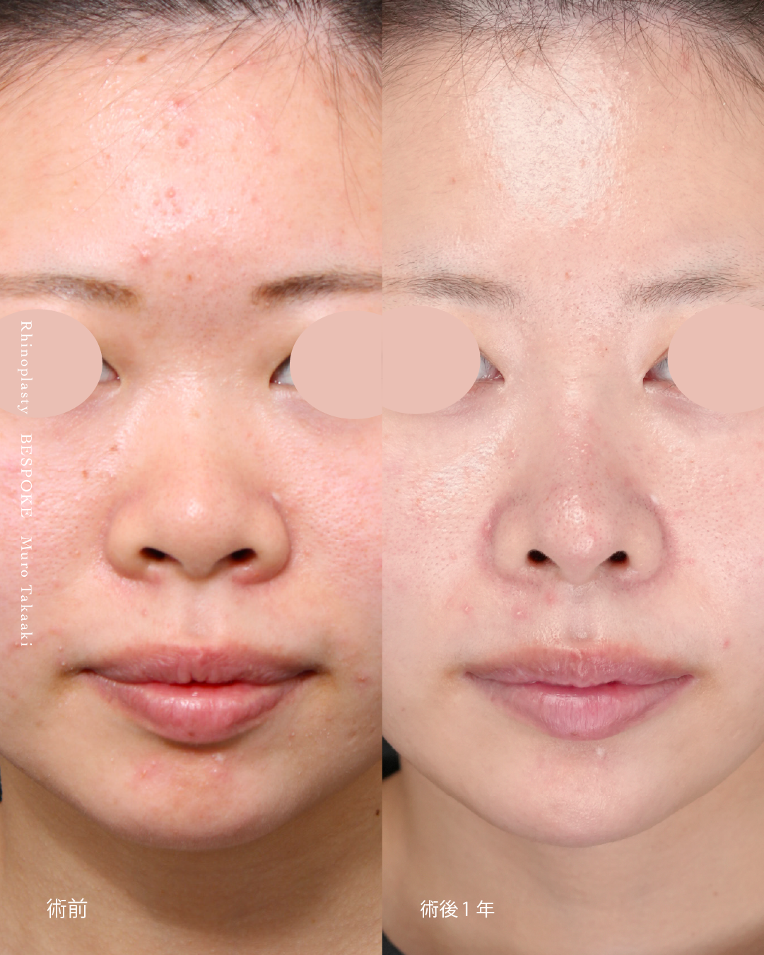 【鼻】”団子鼻”・”あぐら鼻”・”鼻先”、すべてが丁度いい位置。