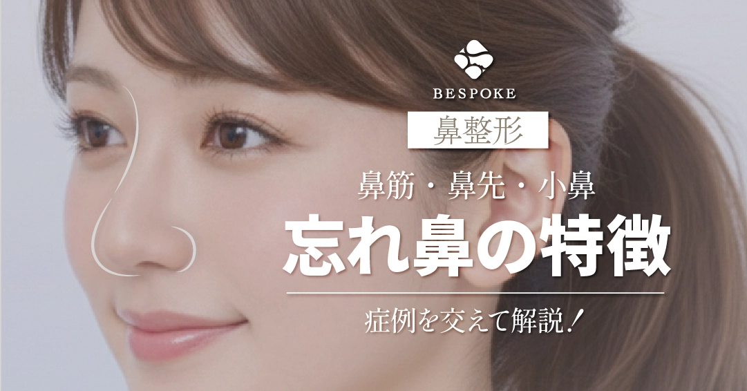 今なりたい「忘れ鼻」の条件とは？理想の鼻の特徴や似合う顔立ちを徹底分析