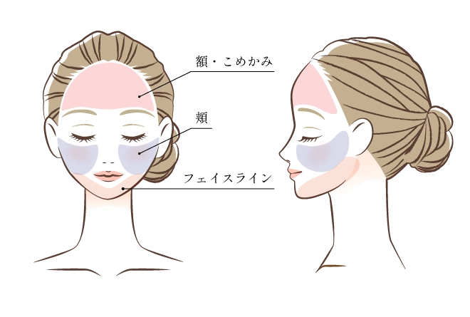 プルリアルデンシファイの施術場所