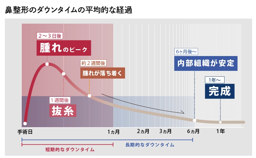 鼻整形のダウンタイム