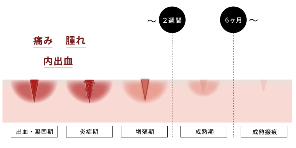 ダウンタイムの当日～6ヶ月までのイメージ