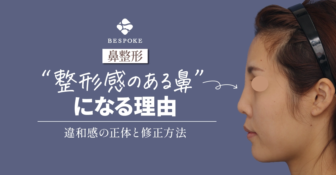 鼻整形がバレバレに？不自然な鼻になる理由と修正手術で自然にするポイント