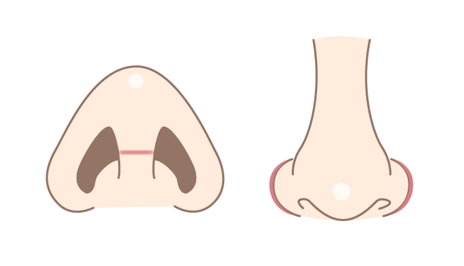 傷跡が目立っている