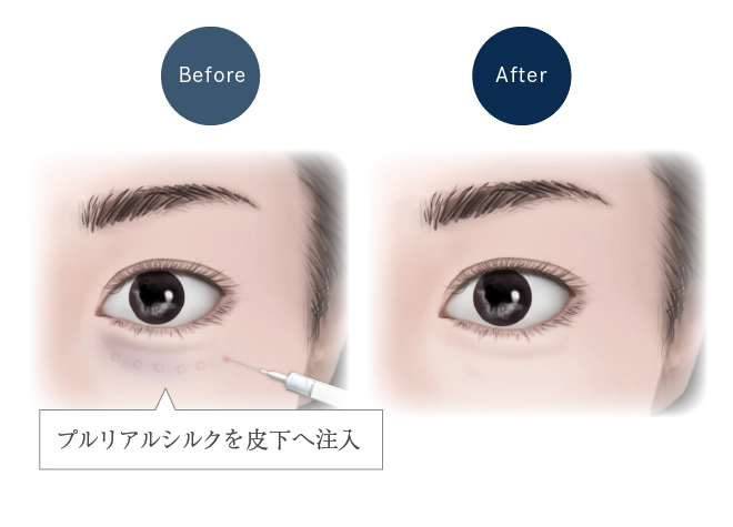 プルリアルシルクイメージ