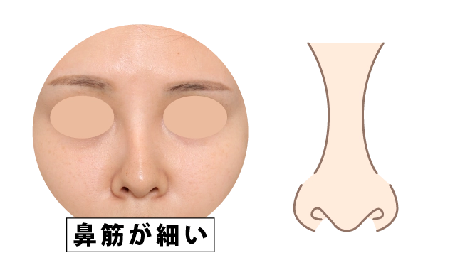 鼻筋が細い