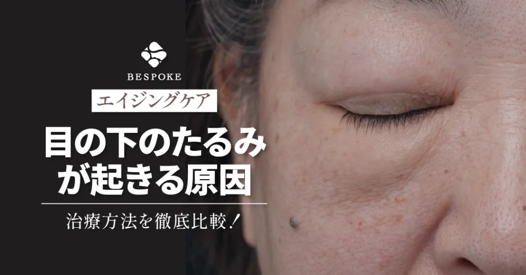 目の下のクマたるみの改善法