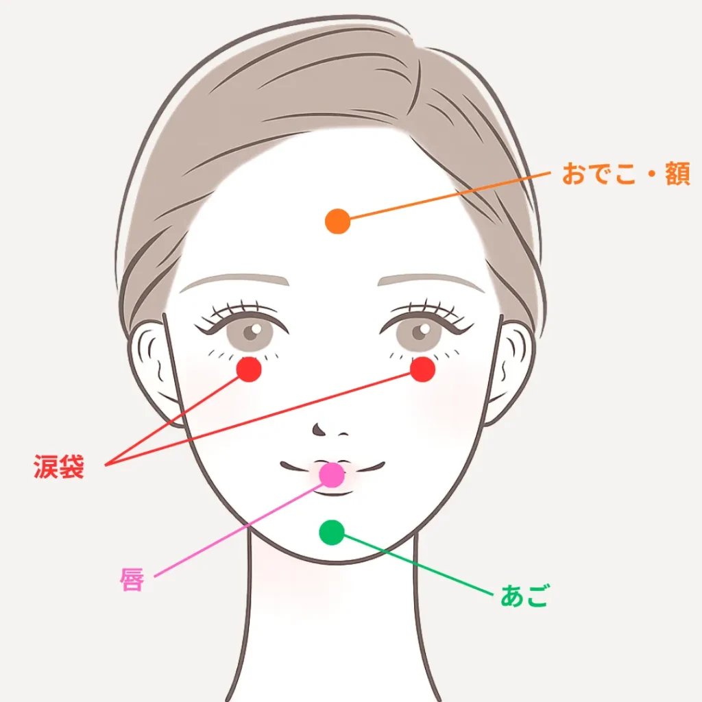 ヒアルロン酸注入おすすめ部位_20代