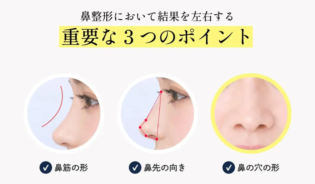 鼻の穴の見え方