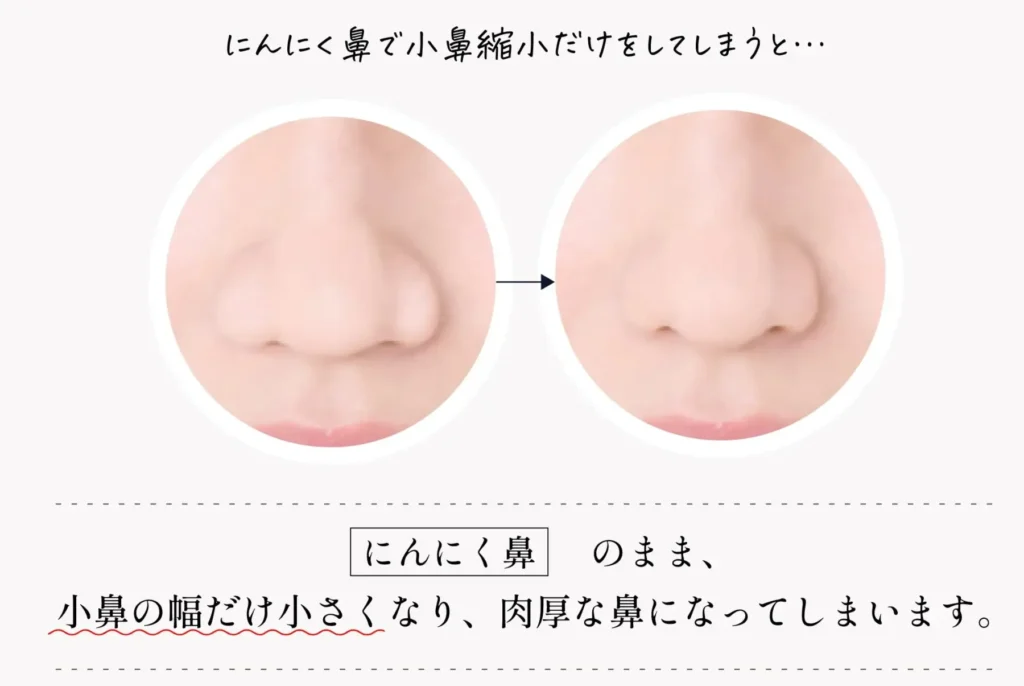 鼻の穴の見え方