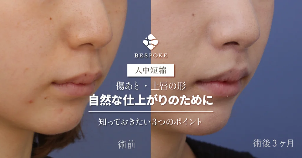 人中短縮術で後悔しないために