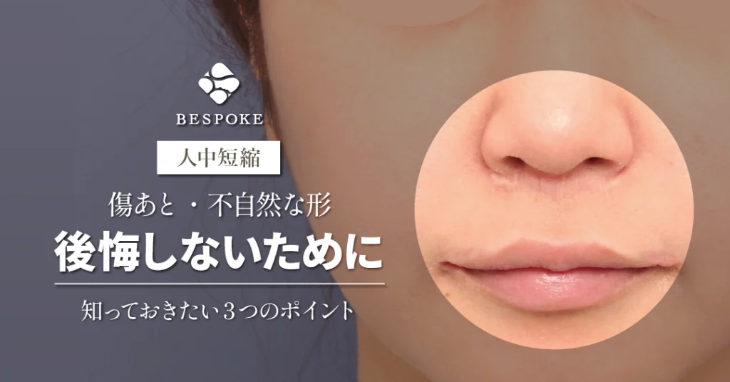 人中短縮術で後悔しないために