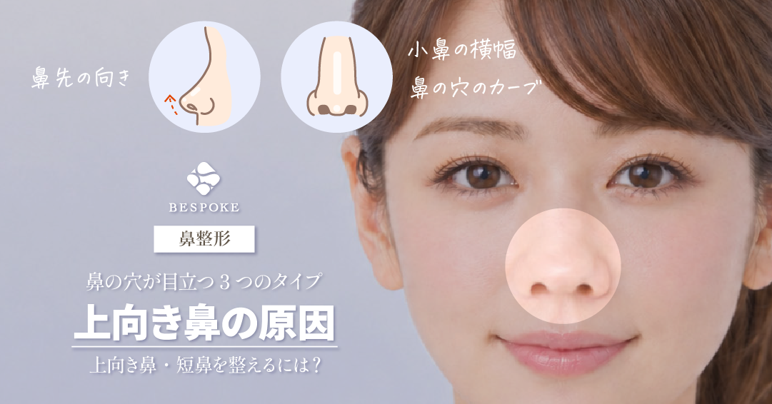短鼻・アップノーズでお悩みの方必見！上向きの鼻を自然に改善する方法