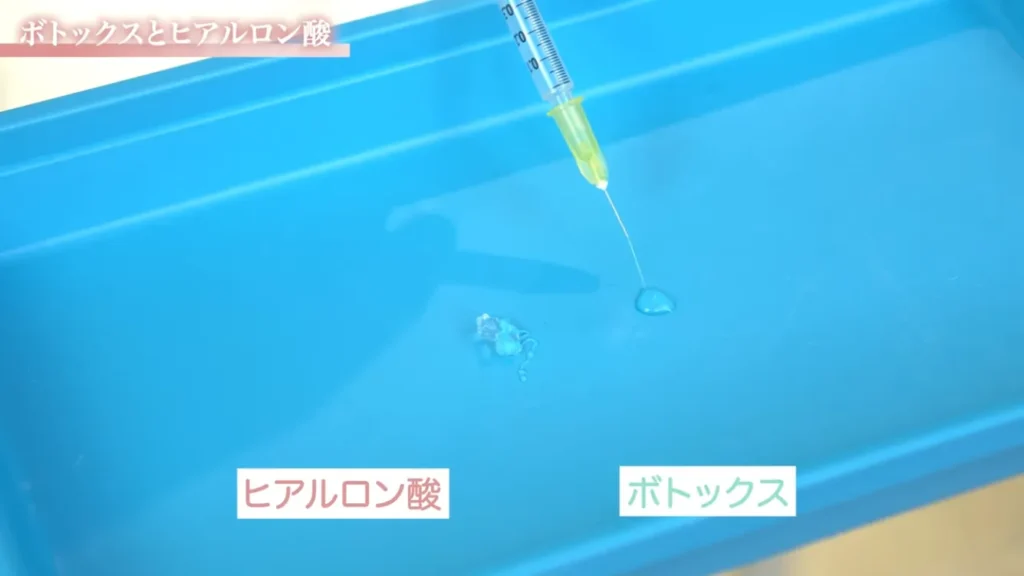 ボトックス基礎知識