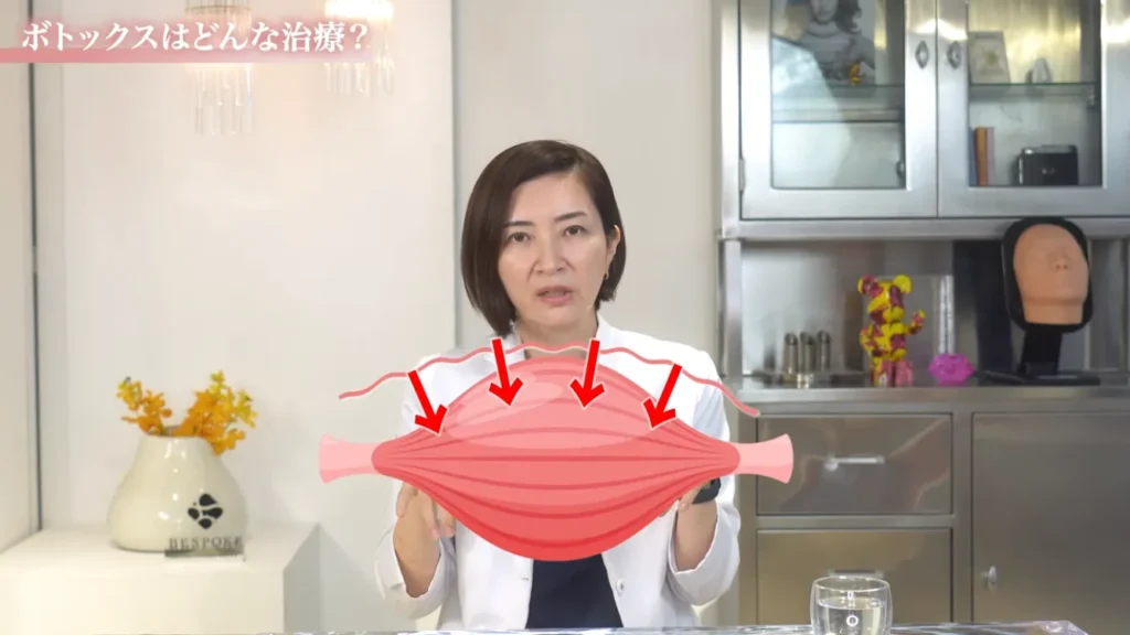 ボトックス基礎知識