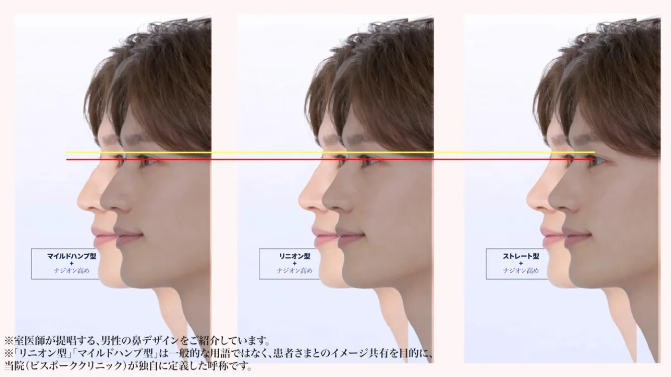 メンズ鼻のデザイン_ナジオンの位置