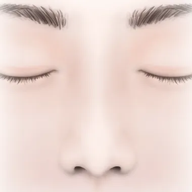 鼻翼延長術_図解