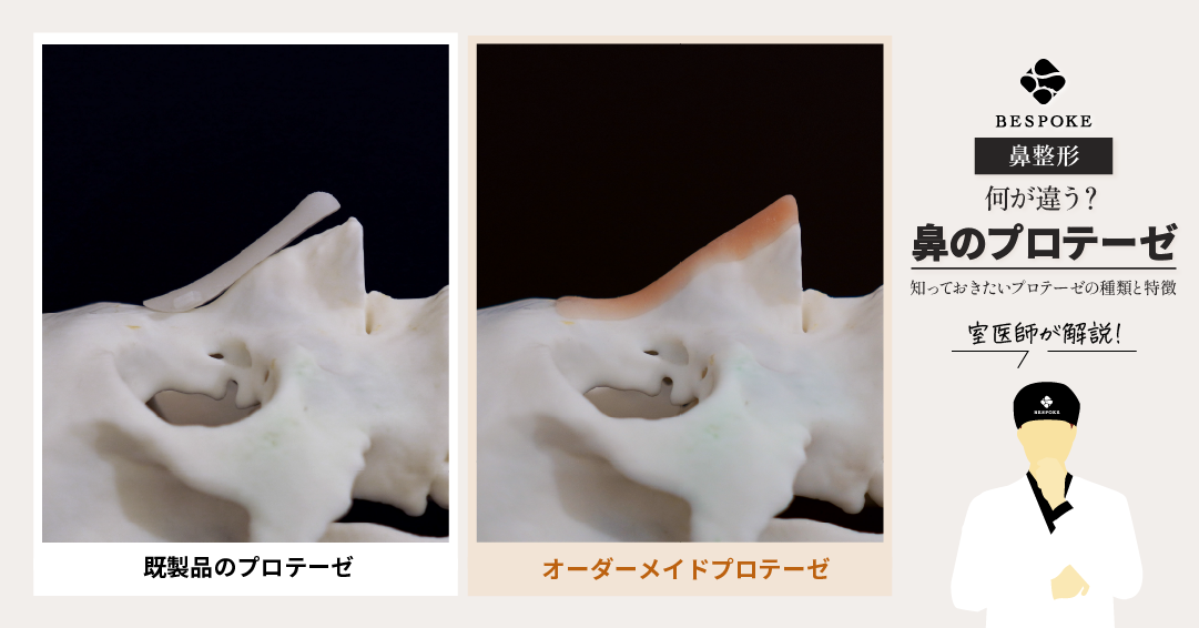 プロテーゼの比較