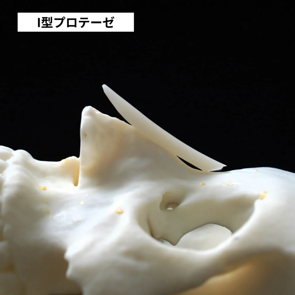 I型シリコン