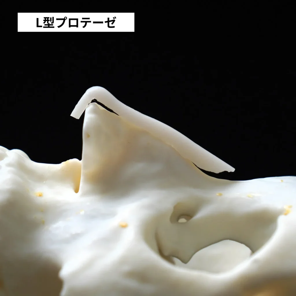L型シリコン