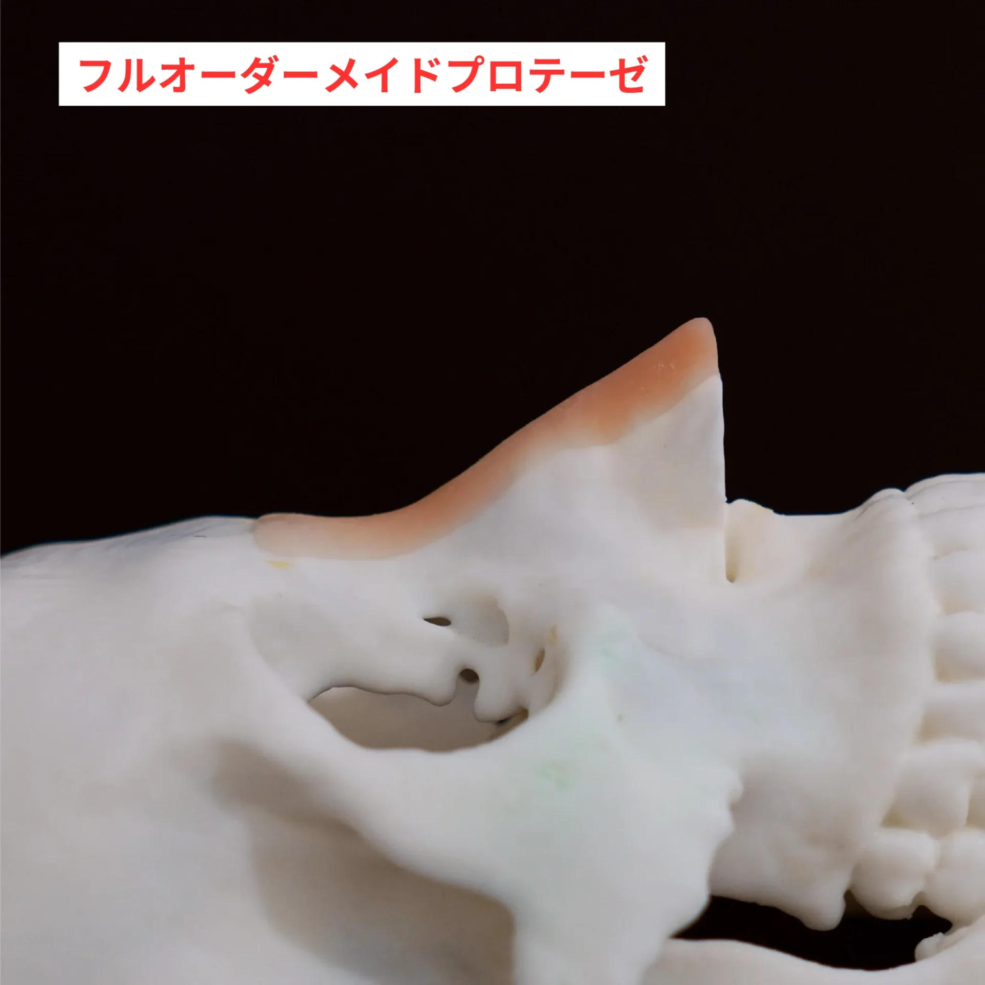 L型シリコン